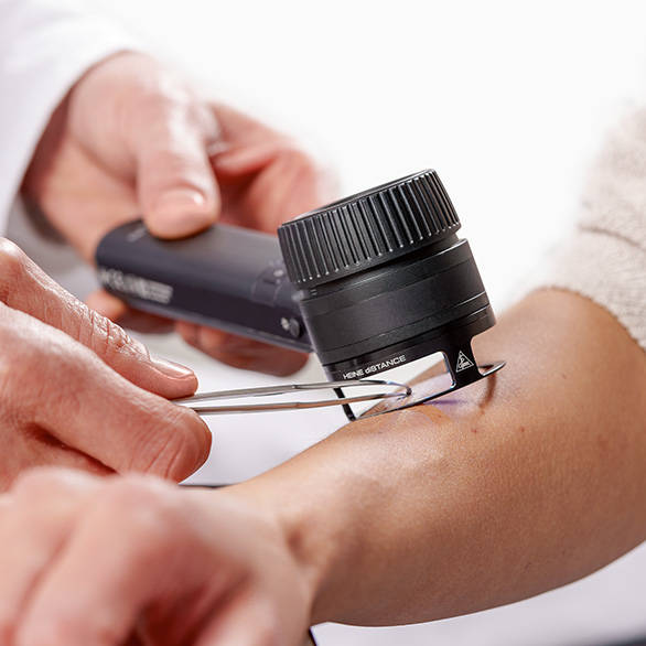 HEINE DELTA 30 PRO dermatoskooppi