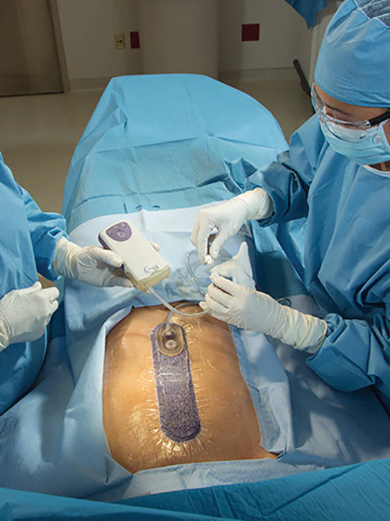 Prevena-hoitoyksikkö